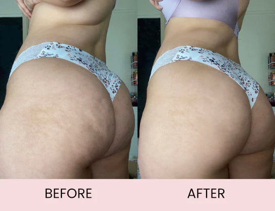 Novoria™ Magic Body Oil — Smooth, Firm & Hydrate Your Skin
