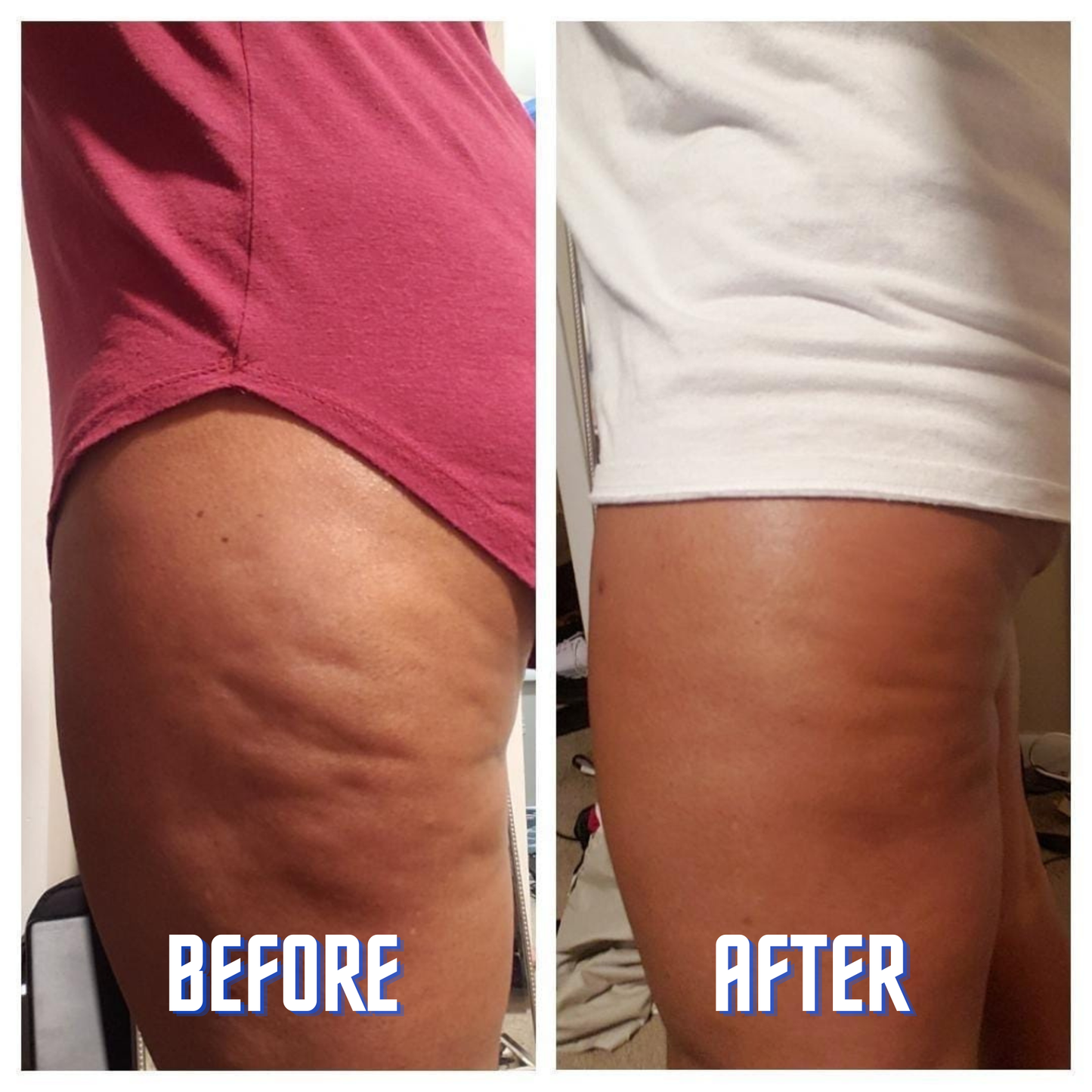 Novoria™ Magic Body Oil — Smooth, Firm & Hydrate Your Skin